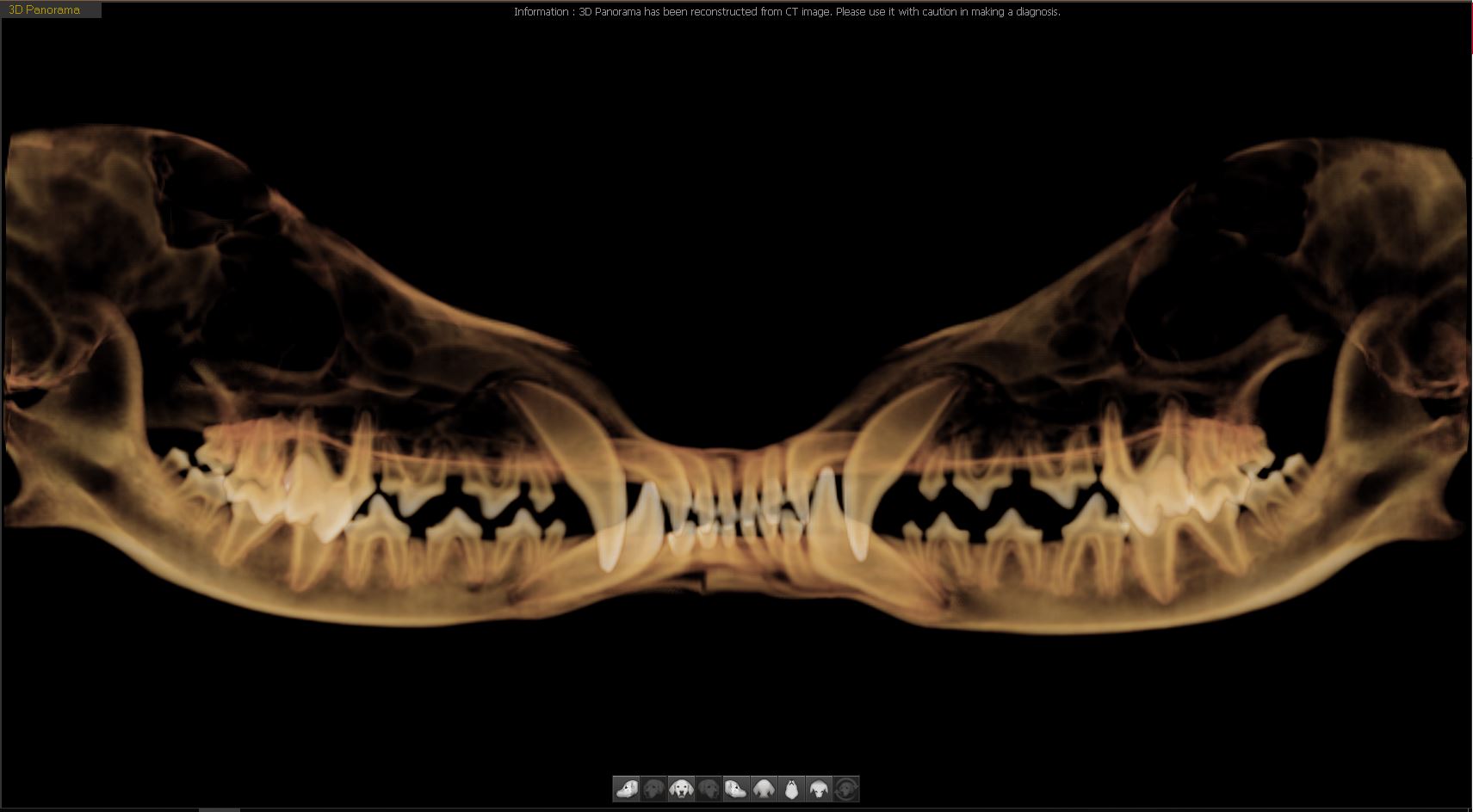 Dental Panorama